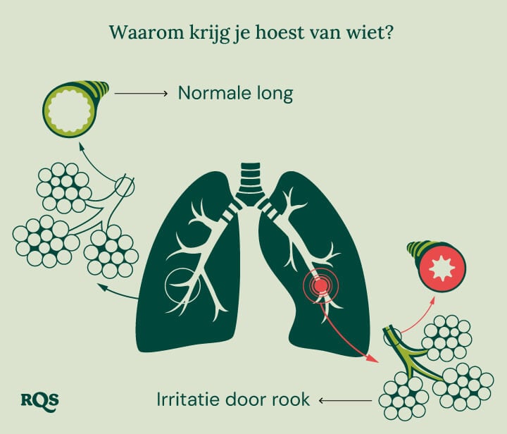 Diagram van de gezonde long vergeleken met de geïrriteerde long met ontsteking en gezwollen bronchieën door het roken van cannabis